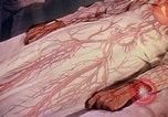 Image of navy sailor recovering from surgery California United States USA, 1945, second 49 stock footage video 65675077527