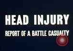 Image of head injury United States USA, 1945, second 30 stock footage video 65675077535