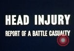 Image of head injury United States USA, 1945, second 31 stock footage video 65675077535