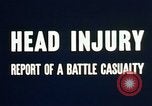 Image of head injury United States USA, 1945, second 32 stock footage video 65675077535