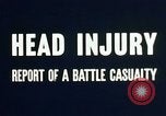 Image of head injury United States USA, 1945, second 35 stock footage video 65675077535