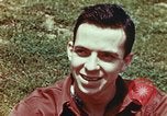 Image of head injury United States USA, 1945, second 42 stock footage video 65675077535