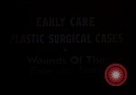 Image of wounded soldier European Theater, 1945, second 9 stock footage video 65675077543