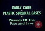 Image of wounded soldier European Theater, 1945, second 10 stock footage video 65675077543