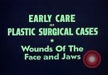 Image of wounded soldier European Theater, 1945, second 11 stock footage video 65675077543