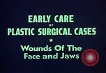Image of wounded soldier European Theater, 1945, second 12 stock footage video 65675077543