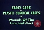 Image of wounded soldier European Theater, 1945, second 13 stock footage video 65675077543