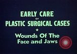 Image of wounded soldier European Theater, 1945, second 14 stock footage video 65675077543