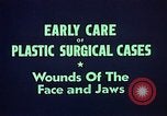 Image of wounded soldier European Theater, 1945, second 15 stock footage video 65675077543