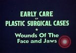 Image of wounded soldier European Theater, 1945, second 16 stock footage video 65675077543