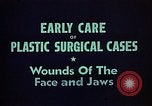 Image of wounded soldier European Theater, 1945, second 17 stock footage video 65675077543