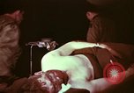 Image of wounded soldier European Theater, 1945, second 10 stock footage video 65675077544
