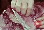Image of wounded soldier European Theater, 1945, second 51 stock footage video 65675077544