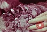 Image of wounded soldier European Theater, 1945, second 53 stock footage video 65675077544