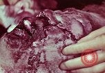Image of wounded soldier European Theater, 1945, second 54 stock footage video 65675077544