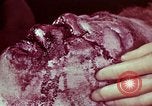 Image of wounded soldier European Theater, 1945, second 55 stock footage video 65675077544