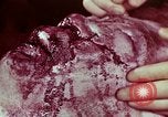 Image of wounded soldier European Theater, 1945, second 57 stock footage video 65675077544