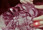 Image of wounded soldier European Theater, 1945, second 58 stock footage video 65675077544