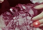 Image of wounded soldier European Theater, 1945, second 59 stock footage video 65675077544
