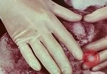 Image of wounded soldier European Theater, 1945, second 60 stock footage video 65675077544