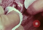 Image of wounded soldier European Theater, 1945, second 62 stock footage video 65675077544