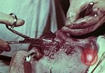 Image of wounded soldier European Theater, 1945, second 3 stock footage video 65675077545