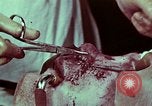 Image of wounded soldier European Theater, 1945, second 8 stock footage video 65675077545