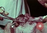 Image of wounded soldier European Theater, 1945, second 9 stock footage video 65675077545