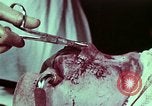 Image of wounded soldier European Theater, 1945, second 10 stock footage video 65675077545