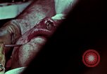 Image of wounded soldier European Theater, 1945, second 24 stock footage video 65675077545