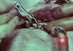 Image of wounded soldier European Theater, 1945, second 26 stock footage video 65675077545