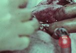 Image of wounded soldier European Theater, 1945, second 27 stock footage video 65675077545