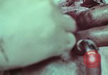 Image of wounded soldier European Theater, 1945, second 28 stock footage video 65675077545