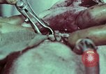 Image of wounded soldier European Theater, 1945, second 29 stock footage video 65675077545