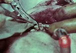 Image of wounded soldier European Theater, 1945, second 30 stock footage video 65675077545