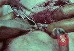 Image of wounded soldier European Theater, 1945, second 32 stock footage video 65675077545