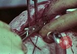 Image of wounded soldier European Theater, 1945, second 38 stock footage video 65675077545