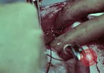 Image of wounded soldier European Theater, 1945, second 40 stock footage video 65675077545