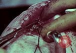Image of wounded soldier European Theater, 1945, second 42 stock footage video 65675077545