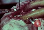 Image of wounded soldier European Theater, 1945, second 46 stock footage video 65675077545