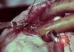 Image of wounded soldier European Theater, 1945, second 49 stock footage video 65675077545