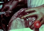 Image of wounded soldier European Theater, 1945, second 57 stock footage video 65675077545