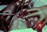 Image of wounded soldier European Theater, 1945, second 60 stock footage video 65675077545
