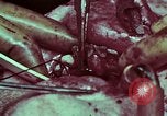 Image of wounded soldier European Theater, 1945, second 62 stock footage video 65675077545