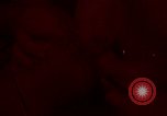 Image of wounded soldier European Theater, 1945, second 1 stock footage video 65675077546