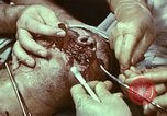 Image of wounded soldier European Theater, 1945, second 3 stock footage video 65675077546