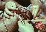 Image of wounded soldier European Theater, 1945, second 4 stock footage video 65675077546
