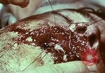 Image of wounded soldier European Theater, 1945, second 6 stock footage video 65675077546
