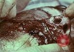 Image of wounded soldier European Theater, 1945, second 10 stock footage video 65675077546