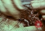 Image of wounded soldier European Theater, 1945, second 13 stock footage video 65675077546